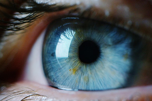Cataracts