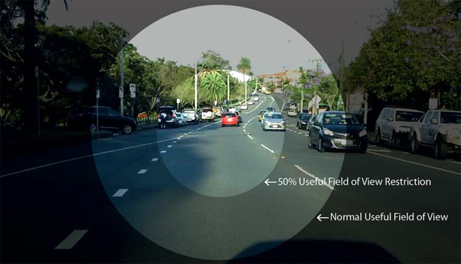 Visual Field